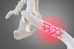 AniFlexi+V2 за регенерацията на съединителната тъкан и намаляването на възпаленията 300гр